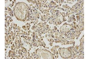 Immunohistochemistry (IHC) image for anti-4-Aminobutyrate Aminotransferase (ABAT) antibody (ABIN1876487) (ABAT Antikörper)