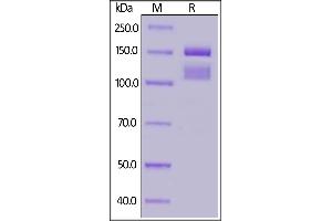 Human ITGA2&ITGB1 Heterodimer Protein, His Tag&Tag Free on  under reducing (R) condition.