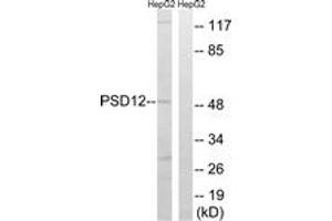 Western blot analysis of extracts from HepG2 cells, using PSMD12 Antibody. (PSMD12 Antikörper  (AA 151-200))