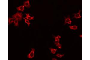 ABIN6266893 staining HepG2 by IF/ICC. (DOK3 Antikörper  (Internal Region))