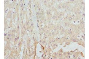 Immunohistochemistry of paraffin-embedded human liver tissue using ABIN7152931 at dilution of 1:100 (FCN1 Antikörper  (AA 30-326))