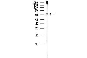 anti-Interferon-Induced Protein with Tetratricopeptide Repeats 1 (IFIT1) (Internal Region) antibody