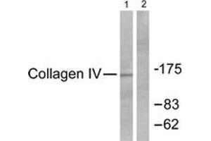 Western blot analysis of extracts from HeLa cells, using Collagen IV Antibody. (Collagen IV Antikörper  (AA 11-60))