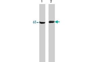 Western blot of A-431 cells untreated (lane 1) or treated with pervanadate (lane 2). (PDPK1 Antikörper  (N-Term))