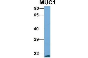 Host:  Rabbit  Target Name:  MUC1  Sample Type:  721_B  Antibody Dilution:  1. (MUC1 Antikörper  (N-Term))
