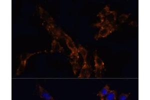 Immunofluorescence analysis of NIH/3T3 cells using TGFB1 Polyclonal Antibody at dilution of 1:100. (TGFB1 Antikörper)