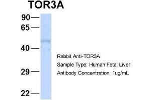 Hum. (TOR3A Antikörper  (Middle Region))