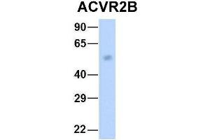 Western Blotting (WB) image for anti-Activin A Receptor, Type IIB (ACVR2B) (Middle Region) antibody (ABIN2782110)