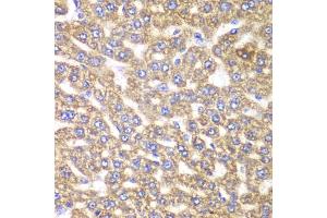 Immunohistochemistry of paraffin-embedded rat liver using UGDH antibody (ABIN6293152) at dilution of 1:100 (40x lens). (UGDH Antikörper)