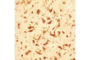 Macrophages stained with ABIN119773 using enhanced DAB in experimental allergic marmoset brain.