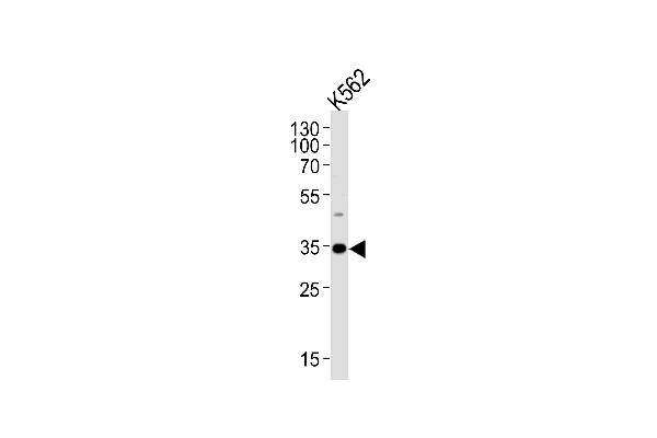 BBS5 anticorps  (AA 108-141)