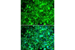 Immunofluorescence analysis of U2OS cells using ADIPOR1 antibody (ABIN5970705). (Adiponectin Receptor 1 Antikörper)