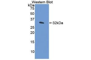 Western blot analysis of the recombinant protein. (IRF6 Antikörper  (AA 196-445))