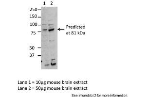 Sample Type: Lane1 = 10ug mouse brain extract, Lane 2 = 50ug mouse brain extractPrimary Antibody Dilution: Anti-MARK3 1:2500Submitted By: Dr. (MARK3 Antikörper  (Middle Region))