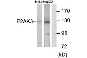 Western Blotting (WB) image for anti-Eukaryotic Translation Initiation Factor 2-alpha Kinase 3 (EIF2AK3) (N-Term) antibody (ABIN1850024) (PERK Antikörper  (N-Term))