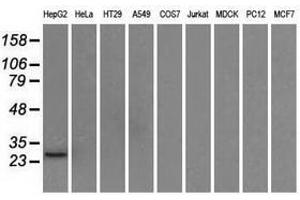 Image no. 3 for anti-Hydroxysteroid (17-Beta) Dehydrogenase 10 (HSD17B10) antibody (ABIN1498723)