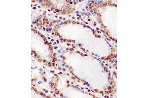 (ABIN6243590 and ABIN6578256) staining HNRNPUL2 in human stomach tissue sections by Immunohistochemistry (IHC-P - paraformaldehyde-fixed, paraffin-embedded sections). (HNRNPUL2 Antikörper  (AA 337-350))