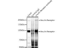 Immunoprecipitation analysis of 300 μg extracts of HeLa cells using 3 μg Insulin Receptor antibody (ABIN7267890). (Insulin Receptor Antikörper  (AA 1281-1382))