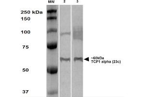 Western Blot analysis of Human A431 and HEK293 cell lysates showing detection of TCP1 alpha protein using Rat Anti-TCP1 alpha Monoclonal Antibody, Clone 23c . (TCP1 alpha/CCTA Antikörper  (C-Term) (PE))
