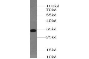 Western blot analysis of Jurkat cells subjected to SDS-PAGE using UCK2 Antibody at a dilution of 1/500. (UCK2 Antikörper)