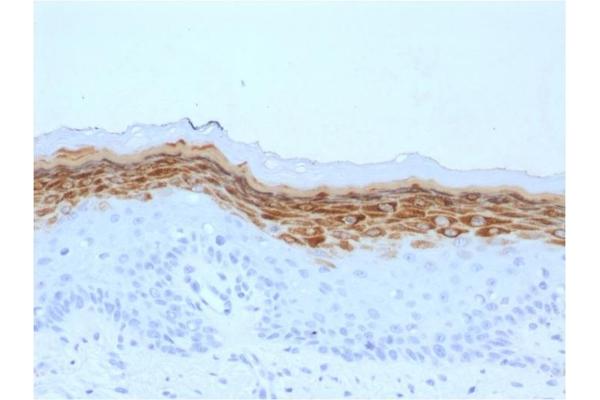 Filaggrin anticorps  (AA 198-288)