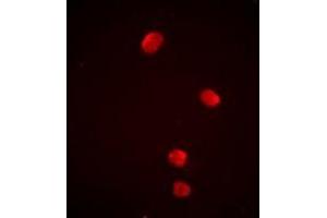 Immunofluorescent analysis of PSMD13 staining in Jurkat cells. (PSMD13 Antikörper)