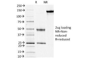 SDS-PAGE (SDS) image for anti-CD3 epsilon (CD3E) (AA 156-168), (Cytoplasmic Domain) antibody (ABIN4949516)