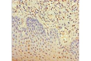 Immunohistochemistry of paraffin-embedded human tonsil tissue using ABIN7146073 at dilution of 1:100 (CLEC4D Antikörper  (AA 39-215))