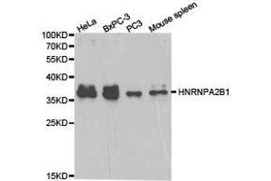 Western Blotting (WB) image for anti-Heterogeneous Nuclear Ribonucleoprotein A2/B1 (HNRNPA2B1) antibody (ABIN1873065) (HNRNPA2B1 Antikörper)