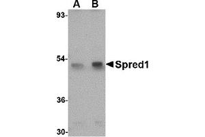 Western Blotting (WB) image for anti-Sprouty-Related, EVH1 Domain Containing 1 (SPRED1) (Middle Region 1) antibody (ABIN1031192)