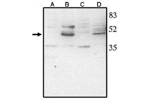 Western Blotting (WB) image for anti-Visual System Homeobox 2 (VSX2) antibody (ABIN293468) (VSX2 Antikörper)