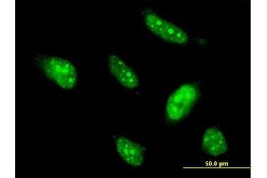 Immunofluorescence of monoclonal antibody to BTG4 on HeLa cell.