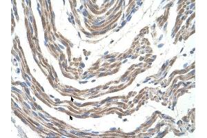 STK11 antibody was used for immunohistochemistry at a concentration of 4-8 ug/ml to stain Skeletal muscle cells (arrows) in Human Muscle. (LKB1 Antikörper  (N-Term))