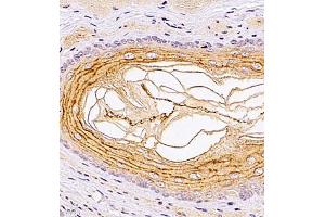 Immunohistochemistry of paraffin embedded rat esophagus using TR2IT1 (ABIN7075887) at dilution of 1:1500 (400x lens) (TXNRD3NB Antikörper)