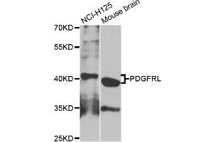 Western blot analysis of extracts of NCI-H125 cells, using PDGFRL antibody (ABIN5995942) at 1/1000 dilution. (PDGFRL Antikörper)