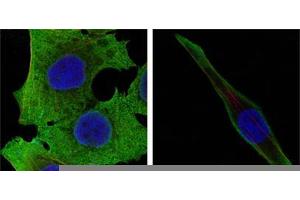 Confocal immunofluorescence analysis of PANC-1 (left) and SKBR-3 (right) cells using SOD1 mouse mAb (green). (SOD1 Antikörper)