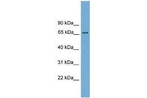 Western Blotting (WB) image for anti-Protein Phosphatase 2, Regulatory Subunit B', delta (PPP2R5D) (Middle Region) antibody (ABIN2787385)