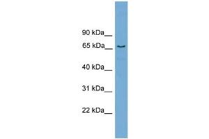 WB Suggested Anti-PPP2R5D Antibody Titration: 0. (PPP2R5D Antikörper  (Middle Region))