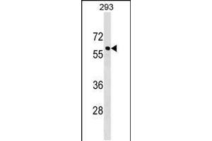 Western blot analysis in 293 cell line lysates (35ug/lane). (CACNB3 Antikörper  (C-Term))