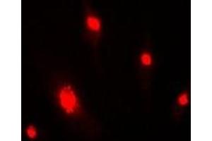 Immunofluorescent analysis of DDB2 staining in MCF7 cells. (DDB2 Antikörper)
