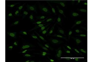 Immunofluorescence of monoclonal antibody to CDC2L6 on HeLa cell. (CDK19 Antikörper  (AA 1-114))
