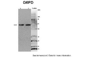 Sample type: 1. (Glucose-6-Phosphate Dehydrogenase Antikörper  (Middle Region))