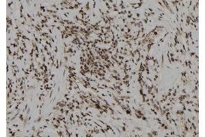 ABIN6274008 at 1/100 staining Human gastric tissue by IHC-P. (DUSP6 Antikörper  (Internal Region))