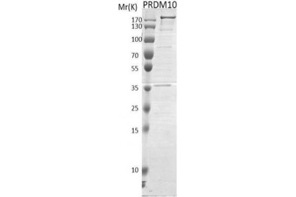 PRDM10 Protein (DYKDDDDK Tag)