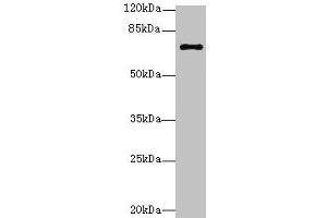Western blot All lanes: RHOBTB3 antibody at 12 μg/mL + Hela whole cell lysate Secondary Goat polyclonal to rabbit IgG at 1/10000 dilution Predicted band size: 70 kDa Observed band size: 70 kDa (RHOBTB3 Antikörper  (AA 251-500))