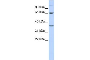 WB Suggested Anti-EPN2 Antibody Titration: 0. (Epsin 2 Antikörper  (Middle Region))