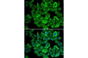 Immunofluorescence (IF) image for anti-alpha Ketoglutarate Dehydrogenase (alphaKGDHC) (AA 148-427) antibody (ABIN6145003)