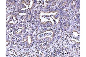 IHC analysis of ATP5F1B using anti-ATP5F1B antibody (ABIN7599866). (Atp5f1b (AA 123-529) Antikörper)