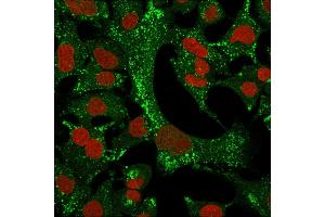 Immunofluorescence Analysis of A549 cells labeling KRT4 with Cytokeratin 4 Mouse Monoclonal Antibody (KRT4/2804)followed by Goat anti-Mouse IgG-CF488 (Green).