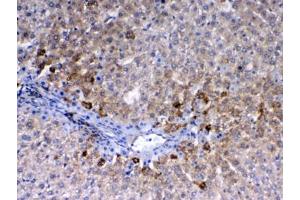 IHC testing of FFPE rat liver tissue with CD105 antibody at 1ug/ml. (Endoglin Antikörper)
